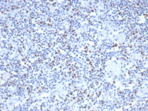 Recombinant MSH6 Antibody MSH6/6654R in Dog Lymph Node IHC. Immunohistochemistry testing of Recombinant MSH6 Antibody, clone MSH6/6654R, in FFPE dog lymph node tissue. Heat-induced epitope retrieval was performed in Tris/EDTA buffer, pH 9.0, for 45 min. An HRP-polymer secondary detection system was applied for 30 min followed by DAB for 5 min. Nuclear staining is observed in a subset of lymphoid cells, consistent with the nuclear localization of MSH6.