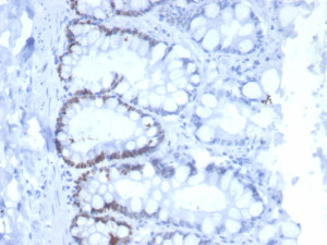 Recombinant MSH6 Antibody MSH6/6654R in Cat Colon IHC. Immunohistochemistry testing of Recombinant MSH6 Antibody, clone MSH6/6654R, in FFPE cat colon tissue. Heat-induced epitope retrieval was performed in Tris/EDTA buffer, pH 9.0, for 45 min. An HRP-polymer secondary detection system was applied for 30 min followed by DAB for 5 min. Nuclear staining is observed in colonic epithelial cells, consistent with the nuclear localization of MSH6.