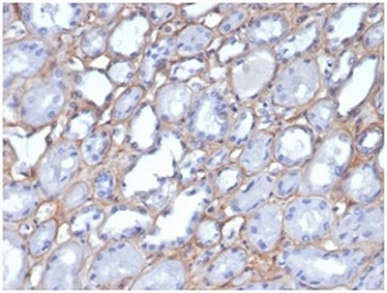 Immunohistochemistry of Collagen IV antibody in human kidney tissue. Formalin-fixed, paraffin-embedded human kidney was stained using Collagen IV antibody clone M3F7. Heat induced epitope retrieval was performed by boiling tissue sections in 10mM Tris with 1mM EDTA, pH 9, for 20 min followed by cooling prior to staining. HRP-DAB brown chromogenic signal outlines glomerular and tubular basement membranes, demonstrating the characteristic linear extracellular staining pattern of Collagen type IV within renal tissue.