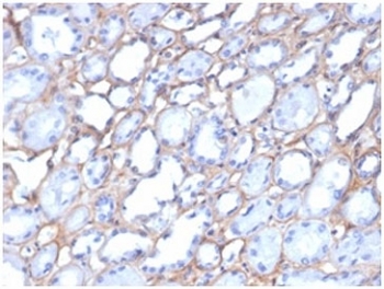 IHC staining of FFPE human kidney tissue with Collagen IV antibody clone M3F7. HIER: boil tissue sections in pH 9 10mM Tris with 1mM EDTA for 20 min and allow to cool before testing.