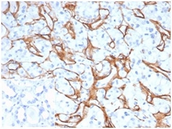 IHC staining of FFPE human kidney adenocarcinoma tissue with Collagen IV antibody clone M3F7 at 2ug/ml in PBS for 30min RT. Strong staining of glomeruli is observed. Negative control inset: PBS instead of primary antibody to control for secondary binding. HIER: boil tissue sections in pH 9 10mM Tris with 1mM EDTA for 20 min and allow to cool before testing.