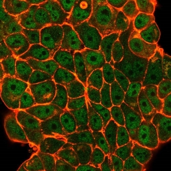ELK1 Antibody MCF-7 IF. Immunofluorescence analysis of PFA-fixed human MCF-7 cells using ELK1 antibody (green) shows predominant nuclear localization consistent with its role as a MAPK-responsive transcription factor regulating ERK-dependent gene expression, while phalloidin (red) highlights the actin cytoskeleton; detection was performed with clone PCRP-ELK1-1D9.