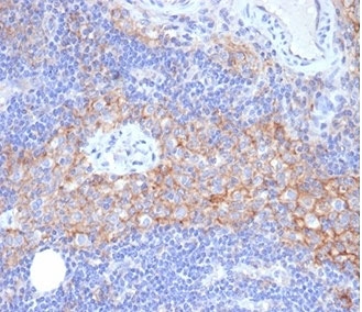 IHC staining of FFPE human lymph node tissue with ICAM1 antibody (clone ICAM1/6319). HIER: boil tissue sections in pH 9 10mM Tris with 1mM EDTA for 20 min and allow to cool before testing.
