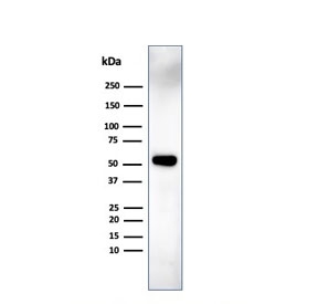 IRF3 Antibody MCF7 WB. Western blot analysis of human MCF7 cell lysate using IRF3 Antibody detects a strong band at approximately 47-50 kDa, consistent with the predicted molecular weight of Interferon regulatory factor 3 / IRF3. This innate immune signaling antibody highlights IRF3-associated antiviral response pathways and interferon-regulatory transcriptional signaling in epithelial-derived breast cancer cells.