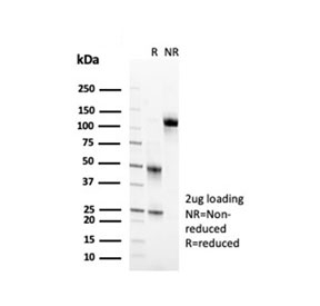 SDS-PAGE analysis of purified, BSA-free CD2 antibody (clone LFA2/7102) as confirmation of integrity and purity.