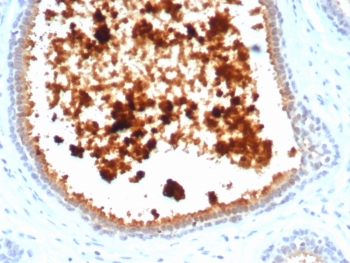 MGB1 Antibody clone MGB/4811R immunohistochemistry of human lactating breast tissue. FFPE human lactating breast tissue was stained with MGB1 antibody (clone MGB/4811R). HRP-DAB brown chromogenic signal highlights strong cytoplasmic staining in secretory epithelial cells lining mammary glandular structures and luminal secretions, consistent with high expression of Mammaglobin A / SCGB2A2 in lactating breast epithelium, while surrounding stromal cells show minimal staining. Heat-induced epitope retrieval was performed by boiling tissue sections in pH 9 10mM Tris with 1mM EDTA for 20 minutes followed by cooling prior to staining.