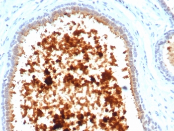 IHC staining of FFPE human lactating breast tissue with MGB1 antibody (clone MGB/4811R). HIER: boil tissue sections in pH 9 10mM Tris with 1mM EDTA for 20 min and allow to cool before testing.