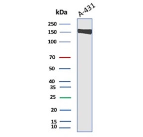 Western blot testing of human A431 cell lysate with EGF Receptor antibody. Expected molecular weight: 134-180 kDa depending on glycosylation level.