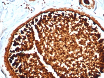 SCGB2A2 Antibody for IHC clone MGB/4812R immunohistochemistry of human lactating breast tissue. FFPE human lactating breast tissue was stained with SCGB2A2 Antibody for IHC. HRP-DAB brown chromogenic signal highlights strong cytoplasmic staining in secretory epithelial cells lining mammary glandular structures, consistent with the high expression of Mammaglobin A / SCGB2A2 in lactating breast epithelium, while surrounding stromal cells show minimal staining. Heat-induced epitope retrieval was performed by boiling tissue sections in pH 9 10mM Tris with 1mM EDTA for 20 minutes followed by cooling prior to staining.
