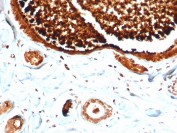 SCGB2A2 Antibody for IHC clone MGB/4812R immunohistochemistry of human lactating breast tissue. FFPE human lactating breast tissue was stained with SCGB2A2 Antibody for IHC. HRP-DAB brown chromogenic signal highlights strong cytoplasmic staining in secretory epithelial cells within mammary glandular structures, consistent with elevated Mammaglobin A / SCGB2A2 expression in lactating breast epithelium, while surrounding stromal cells and connective tissue elements show minimal staining. Heat-induced epitope retrieval was performed by boiling tissue sections in pH 9 10mM Tris with 1mM EDTA for 20 minutes followed by cooling prior to staining.