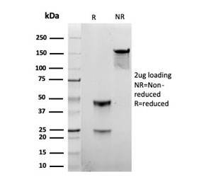 SDS-PAGE analysis of purified, BSA-free Gamma Parvin antibody (clone 8C5.2) as confirmation of integrity and purity.