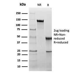 SDS-PAGE analysis of purified, BSA-free recombinant HSP60 antibody (clone rHSPD1/6495) as confirmation of integrity and purity.