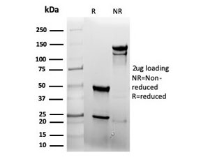 SDS-PAGE analysis of purified, BSA-free recombinant EGF Receptor antibody (clone rEGFR/6389) as confirmation of integrity and purity.