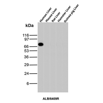 Albumin Antibody Multi-Species Liver WB. Western blot analysis of human, mouse, rat, hamster, and guinea pig liver tissue lysates using Albumin antibody detects a strong band at approximately 65â70 kDa in human liver, consistent with the predicted molecular weight of Albumin (ALB), with minimal signal observed in other species under these conditions; detection was performed with clone ALB/6409R.