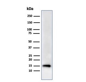 Recombinant FABP5 Antibody HeLa WB. Western blot testing of human HeLa cell lysate using recombinant FABP5 antibody (clone rFABP5/6354). Predicted molecular weight ~15 kDa.