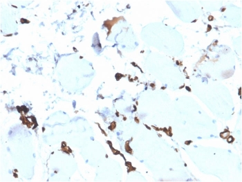 Recombinant FABP5 Antibody Esophagus Immunohistochemistry. IHC staining of FFPE human esophagus tissue with recombinant FABP5 antibody (clone rFABP5/6354). HIER: boil tissue sections in pH 9 10mM Tris with 1mM EDTA for 20 min and allow to cool before testing.