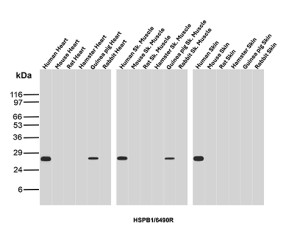 Recombinant HSP27 Antibody HSPB1/6490R Detection Across Multiple Species WB. Western blot analysis of heart, skeletal muscle and skin tissue lysates from human, mouse, rat, guinea pig, hamster and rabbit using Recombinant HSP27 Antibody clone HSPB1/6490R. Strong bands at approximately 27-28 kDa are detected in human heart, skeletal muscle and skin, with weaker bands in guinea pig heart and hamster skeletal muscle. Little to no corresponding signal is observed in the remaining samples, demonstrating species-dependent recognition of HSPB1/HSP27 by this recombinant rabbit monoclonal antibody.