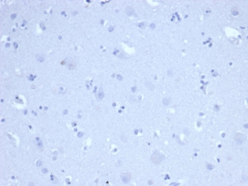 Negative control: IHC staining of FFPE human brain tissue using recombinant Ki-67 antibody (clone MKI67/6517R) at 2ug/ml in PBS for 30min RT. HIER: boil tissue sections in pH 9 10mM Tris with 1mM EDTA for 20 min and allow to cool before testing.