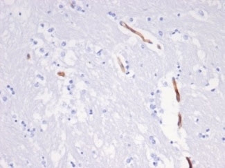 Vimentin Antibody Cow Brain IHC. Immunohistochemistry staining of FFPE cow brain tissue with recombinant Vimentin antibody (clone VIM/6430R). HIER: boil tissue sections in pH 9 10mM Tris with 1mM EDTA for 20 min and allow to cool before testing.