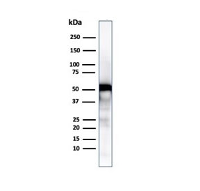 Vimentin Antibody / Wound Healing Marker Antibody WB. Western blot analysis of human U-87 MG cell lysate using Vimentin antibody detects a band at approximately 55 kDa, consistent with the predicted molecular weight of Vimentin (VIM). The band supports detection of cytoskeletal components associated with activated stromal and repair-associated cell states. The presence of Vimentin in U-87 MG cells is consistent with its role in cytoskeletal organization linked to tissue remodeling and wound healing-associated cellular activity.