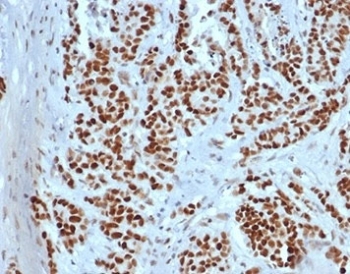 MSH2 Antibody Recombinant Mouse MAb rMSH2/6548. Immunohistochemistry of FFPE human colon tissue demonstrates strong nuclear staining in epithelial cells, consistent with the nuclear localization of MutS homolog 2 (MSH2), a key DNA mismatch repair protein. Brown chromogenic signal highlights MSH2-positive nuclei throughout the colonic epithelium, while surrounding stromal cells show weaker or variable staining. Heat-induced epitope retrieval was performed by boiling tissue sections in pH 9 10mM Tris with 1mM EDTA for 20 minutes followed by cooling prior to antibody incubation.
