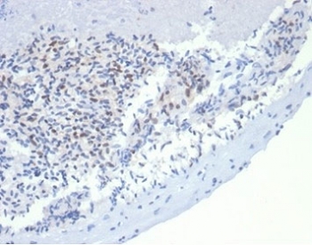 MSH2 Antibody Recombinant Mouse MAb rMSH2/6548. Immunohistochemistry of FFPE dog lymph node tissue demonstrates nuclear staining in lymphoid cells, consistent with the nuclear localization of MutS homolog 2 (MSH2), a DNA mismatch repair protein involved in maintaining genomic stability. Brown chromogenic signal highlights MSH2-positive nuclei among lymphocyte populations within the lymph node architecture, while surrounding stromal elements show weaker or minimal staining. Heat-induced epitope retrieval was performed by boiling tissue sections in pH 9 10mM Tris with 1mM EDTA for 20 minutes followed by cooling prior to antibody incubation.