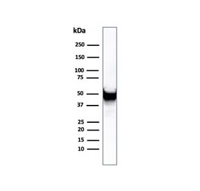 VIM Antibody / Cytoskeletal Stability Marker Antibody WB. Western blot analysis of human U-87 MG cell lysate using Vimentin antibody detects a prominent band at approximately 55 kDa, consistent with the predicted molecular weight of Vimentin (VIM). The recombinant rabbit monoclonal clone rVIM/6431 shows a clear, well-defined band, supporting detection of stable intermediate filament structures. The consistent band intensity reflects Vimentin expression associated with maintained cytoskeletal integrity and structural stability in mesenchymal-like tumor cells.