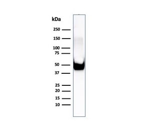 Vimentin Antibody / Cytoskeletal Remodeling Marker Antibody WB. Western blot analysis of human U-87 MG cell lysate using Vimentin antibody detects a strong band at approximately 55 kDa, consistent with the predicted molecular weight of Vimentin (VIM). The rabbit monoclonal clone rVIM/6575 shows a prominent band, supporting detection of intermediate filament components involved in dynamic cytoskeletal reorganization. The banding pattern aligns with Vimentin expression in cells exhibiting active structural adaptation and reinforces its use as a cytoskeletal remodeling marker in mesenchymal and tumor-derived cell systems.
