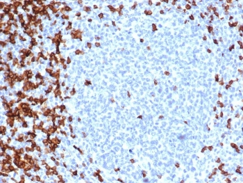 CD7 Antibody for IHC. Immunohistochemistry analysis of CD7 / T-cell antigen CD7 in human tonsil tissue demonstrates strong HRP-DAB brown membranous staining of lymphocytes concentrated in interfollicular regions with relative sparing of germinal centers, consistent with CD7 expression on developing and mature T cell populations. Recombinant CD7 antibody clone CD7/6388R was used following heat-induced epitope retrieval in pH 9 Tris-EDTA buffer, supporting its utility as a T cell development and thymocyte marker in FFPE tissue sections.