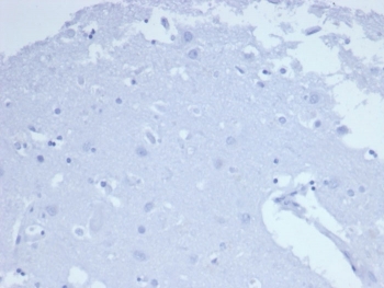 CD7 Antibody Negative Control. Immunohistochemistry analysis of CD7 / T-cell antigen CD7 in human brain tissue shows no HRP-DAB brown staining with only hematoxylin counterstain visible, consistent with the absence of CD7-positive lymphoid cells in non-lymphoid tissue and supporting specificity for thymocyte and T cell populations. Recombinant CD7 antibody clone CD7/6388R was applied at 2 ug/ml following heat-induced epitope retrieval in pH 9 Tris-EDTA buffer, serving as a negative tissue control in FFPE sections.