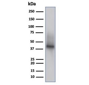 CD38 Antibody human Raji lysate WB. Western blot analysis of CD38 expression in human Raji cell lysate using CD38 antibody clone rCD38/6447. Lane 1: human Raji cell lysate. A band is detected at approximately 40â45 kDa, consistent with the predicted molecular weight of CD38, with higher apparent molecular weight reflecting glycosylation of this cell surface protein and aligning with expression in B cell-derived lines. The detection profile supports its use in studies of immune cell presence within the tumor microenvironment.