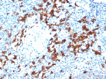 CD38 Antibody human tonsil tissue IHC. Immunohistochemistry analysis of CD38 expression in FFPE human tonsil tissue using CD38 antibody clone rCD38/6447 at 2 ug/ml. Strong membranous and cytoplasmic HRP-DAB brown staining highlights numerous plasma cells and activated lymphocytes within interfollicular regions and surrounding germinal centers, demonstrating dense immune cell distribution. The staining pattern is consistent with detection of immune cell populations within lymphoid tissue architecture, with clear contrast against predominantly negative background lymphocytes. HIER was performed by boiling tissue sections in pH 9 10 mM Tris with 1 mM EDTA for 20 minutes followed by cooling prior to antibody incubation.