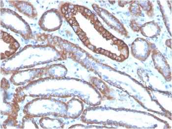 Cadherin 1 Antibody Human Kidney IHC. Immunohistochemistry analysis of Cadherin 1 / CDH1 expression in FFPE human kidney tissue using clone CDH1/4585 antibody, showing membranous HRP-DAB brown staining in epithelial cells lining renal tubules with clear cell-cell junction localization, while surrounding interstitial tissue remains largely negative. HIER: boil tissue sections in pH 9 10mM Tris with 1mM EDTA for 20 min and allow to cool before testing. Signal highlights epithelial organization and adhesion-associated signaling within renal tubular structures.