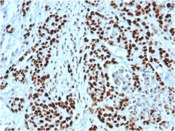 MSH2 Antibody Recombinant Rabbit MAb MSH2/6549R. Immunohistochemistry of FFPE human colon tissue demonstrates strong nuclear staining in epithelial cells, consistent with the nuclear localization of MutS homolog 2 (MSH2), a key DNA mismatch repair protein. Brown chromogenic signal highlights MSH2-positive nuclei throughout the colonic epithelium, while surrounding stromal cells show weaker or variable staining. Heat-induced epitope retrieval was performed by boiling tissue sections in pH 9 10mM Tris with 1mM EDTA for 20 minutes followed by cooling prior to antibody incubation.
