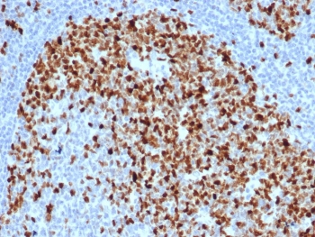 Topoisomerase II alpha Antibody / Mitotic Chromosome Enzyme Antibody (clone TOP2A/6570R). Immunohistochemistry analysis of FFPE human tonsil tissue demonstrates strong nuclear staining of DNA Topoisomerase II alpha in proliferating lymphoid cells. Nuclear immunoreactivity is most prominent within germinal center lymphocytes, reflecting the elevated mitotic activity of these cells where mitotic chromosome condensation and organization are actively occurring. As a Mitotic Chromosome Enzyme Antibody, clone TOP2A/6570R highlights cells undergoing mitosis in which DNA Topoisomerase II alpha supports mitotic chromosome architecture and chromosome condensation required for accurate cell division. HIER: boil tissue sections in pH 9 Tris-EDTA buffer for 20 min followed by cooling at RT prior to immunohistochemistry staining.