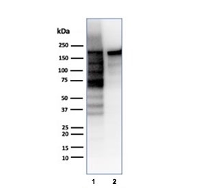 Topoisomerase II alpha Antibody / Mitotic Chromosome Enzyme Antibody (clone TOP2A/6570R). Western blot analysis of human cell lysates demonstrates detection of DNA Topoisomerase II alpha following SDS-PAGE separation and membrane transfer. Lane 1: HeLa cell lysate. Lane 2: Jurkat cell lysate. A band is detected at approximately 170-180 kDa, consistent with the predicted molecular weight of DNA Topoisomerase II alpha / TOP2A (~174 kDa). The detected protein corresponds to the mitotic chromosome enzyme responsible for regulating DNA topology during chromosome condensation and mitotic chromosome organization. Detection of the denatured TOP2A protein band supports the use of this Mitotic Chromosome Enzyme Antibody for western blot analysis of this mitotic chromosome regulatory enzyme in human cell lysates.