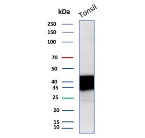 Apolipoprotein J Antibody Tonsil WB. Western blot analysis of human tonsil tissue lysate using Apolipoprotein J antibody. The mouse monoclonal antibody clone CLU/4731 detects bands at approximately 75-80 kDa and lower molecular weight bands around 34-39 kDa, consistent with the predicted molecular weight of full-length Clusterin / Apolipoprotein J and its processed alpha and beta subunits. This banding pattern reflects proteolytic cleavage and glycosylation of this secreted chaperone protein, supporting its role in protein aggregation control and amyloid-associated biology in western blot analysis.