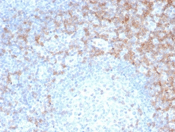 CD5 Antibody for IHC. Immunohistochemistry analysis of CD5 antibody staining in FFPE human tonsil tissue using a T cell activation regulator antibody, clone rC5/6462. Strong membranous staining is observed in T lymphocytes within interfollicular regions, with dense labeling surrounding germinal centers while follicular B cell areas remain largely negative. The staining pattern highlights normal tonsillar architecture and reflects the role of CD5 in regulating T cell activation within lymphoid compartments. Heat-induced epitope retrieval was performed using pH 9 Tris-EDTA buffer for 20 minutes followed by cooling prior to antibody incubation.