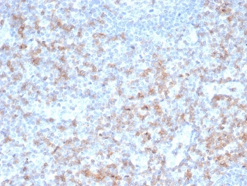 CD5 Antibody. Immunohistochemistry analysis of CD5 antibody staining in FFPE human tonsil tissue using a T cell activation regulator antibody, clone rC5/6462. Strong membranous staining is observed in interfollicular T lymphocytes with widespread distribution across T cell zones, while germinal center B cell regions remain largely negative. The staining pattern reflects the role of CD5 in modulating T cell activation within lymphoid tissue and supports clear identification of T cell-rich compartments. Heat-induced epitope retrieval was performed using pH 9 Tris-EDTA buffer for 20 minutes followed by cooling prior to antibody incubation.