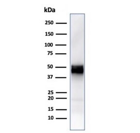 CD5 Antibody for WB. Western blot analysis of CD5 antibody in human Jurkat cell lysate using an immune tolerance regulator antibody, clone rC5/6429. A band is detected at approximately 55-67 kDa, consistent with the predicted molecular weight of CD5, with size variation reflecting known glycosylation of this membrane glycoprotein. The strong signal observed in this T cell-derived lysate aligns with the established role of CD5 in regulating immune tolerance in T lymphocytes.