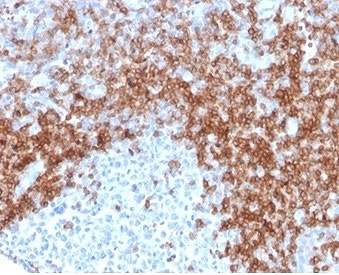 CD5 Antibody. Immunohistochemistry analysis of CD5 antibody staining in FFPE human tonsil tissue using an immune tolerance regulator antibody, clone rC5/6429. Strong membranous staining is observed in interfollicular T lymphocytes with dense labeling of T cell zones surrounding germinal centers, while follicular B cell regions remain largely negative. The staining pattern highlights normal tonsillar architecture and reflects the role of CD5 in maintaining immune tolerance within lymphoid tissue. Heat-induced epitope retrieval was performed using pH 9 Tris-EDTA buffer for 20 minutes followed by cooling prior to antibody incubation.