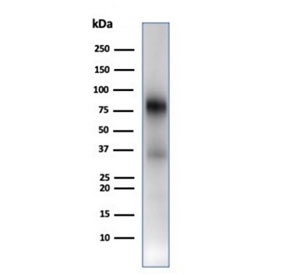 Myeloperoxidase (MPO) Antibody Human Spleen WB. Western blot analysis of human spleen tissue lysate using Myeloperoxidase Antibody / Neutrophil Marker Antibody (clone rMPO/6904) demonstrates a prominent immunoreactive band at approximately 60-70 kDa, consistent with the expected molecular weight of the mature Myeloperoxidase (MPO) heavy chain. MPO is a heme-containing lysosomal peroxidase abundantly expressed in neutrophils, granulocytes, and other myeloid lineage cells, where it contributes to antimicrobial defense through the generation of reactive oxidant species. The observed molecular weight is consistent with the heavily glycosylated nature of MPO, which frequently migrates above its calculated molecular mass during SDS-PAGE analysis. Detection in spleen tissue is consistent with the presence of resident and circulating myeloid cell populations expressing MPO. Expected molecular weight: approximately 59-64 kDa for the mature heavy chain, with higher molecular weight glycosylated and precursor forms potentially observed in myeloid tissues. Observed molecular weight: ~60-70 kDa.