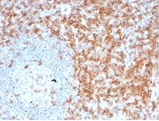 CD5 Antibody. Immunohistochemistry analysis of CD5 antibody staining in FFPE human tonsil tissue using a lymphocyte signaling modulator antibody, clone C5/6463R. Strong membranous staining is observed in interfollicular T lymphocytes with dense labeling of T cell zones surrounding germinal centers, while follicular B cell areas remain largely negative. The staining pattern highlights normal tonsillar architecture and reflects the role of CD5 in modulating lymphocyte signaling within immune compartments. Heat-induced epitope retrieval was performed using pH 9 Tris-EDTA buffer for 20 minutes followed by cooling prior to antibody incubation.