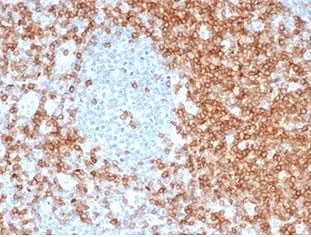 CD5 Antibody for IHC. Immunohistochemistry analysis of CD5 antibody staining in FFPE human tonsil tissue using a lymphocyte signaling modulator antibody, clone C5/6463R. Strong membranous staining is observed in interfollicular T lymphocytes with broad distribution across T cell zones, while germinal center B cell regions remain largely negative. The staining pattern highlights normal tonsillar architecture and reflects the role of CD5 in modulating lymphocyte signaling within immune compartments. Heat-induced epitope retrieval was performed using pH 9 Tris-EDTA buffer for 20 minutes followed by cooling prior to antibody incubation.