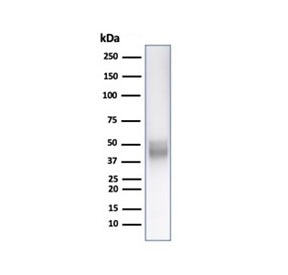 CD5 Antibody for WB. Western blot analysis of CD5 antibody in human Jurkat cell lysate using a T cell development marker antibody, clone C5/6438R. A band is detected at approximately 55-67 kDa, consistent with the predicted molecular weight of CD5, with size variation reflecting known glycosylation of this membrane glycoprotein. The strong signal observed in this T cell-derived lysate aligns with the established role of CD5 in thymocyte maturation and T cell development.