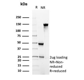 SDS-PAGE analysis of purified, BSA-free recombinant ALK antibody (clone ALK1/6698R) as confirmation of integrity and purity.