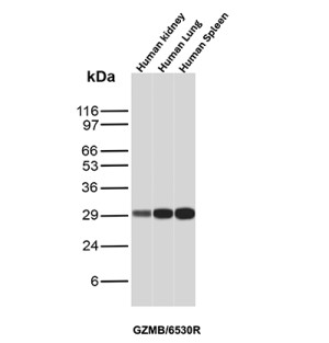 GZMB Antibody in Human Kidney, Lung and Spleen WB. Western blot testing of GZMB Antibody / Granzyme B in human kidney, lung and spleen tissue lysates. A strong, discrete band is observed at approximately 29-30 kDa in all three tissues, with stronger signal in lung and spleen. This GZMB Antibody demonstrates detection of endogenous Granzyme B across the tested human tissues.