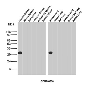 GZMB Antibody in Multi-Species Spleen and Lung WB. Western blot testing of GZMB Antibody / Granzyme B in spleen and lung tissue lysates from human, mouse, rat, hamster, guinea pig and rabbit. A strong, discrete band is observed at approximately 31-32 kDa in human spleen and human lung, while no corresponding band is detected in the tested mouse, rat, hamster, guinea pig or rabbit tissues. This GZMB Antibody demonstrates detection of endogenous Granzyme B in the tested human tissues.
