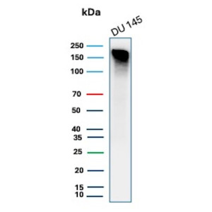 Western blot testing of human DU 145 cell lysate using recombinant MSH6 antibody (clone MSH6/4592R). Expected molecular weight: 120-160 kDa depending on phosphorylation level.