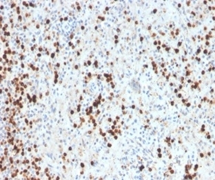 Myeloperoxidase Antibody Rabbit Monoclonal MPO/33R / MPO Antibody. Immunohistochemistry analysis of Myeloperoxidase Antibody Rabbit Monoclonal MPO/33R in FFPE human spleen tissue. Brown chromogenic staining identifies cytoplasmic Myeloperoxidase / MPO-positive myeloid cells distributed throughout the splenic tissue. Heat-induced epitope retrieval was performed by boiling tissue sections in pH 9 10mM Tris with 1mM EDTA for 20 minutes followed by cooling prior to staining.